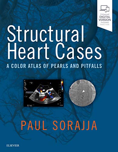 Structural Heart Cases: A Color Atlas of Pearls and Pitfalls von Elsevier